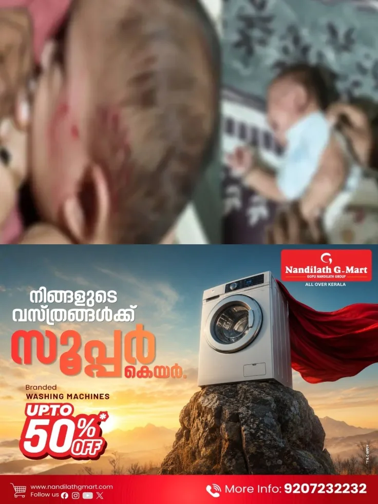 മലപ്പുറത്ത് വീട്ടിൽ ഉറങ്ങിക്കിടന്ന അഞ്ചുമാസം പ്രായമുള്ള കുഞ്ഞിനെ തെരുവുനായ കടിച്ചു; കുട്ടിയുടെ തലയ്ക്കും കൈയ്ക്കും പരിക്കേറ്റു