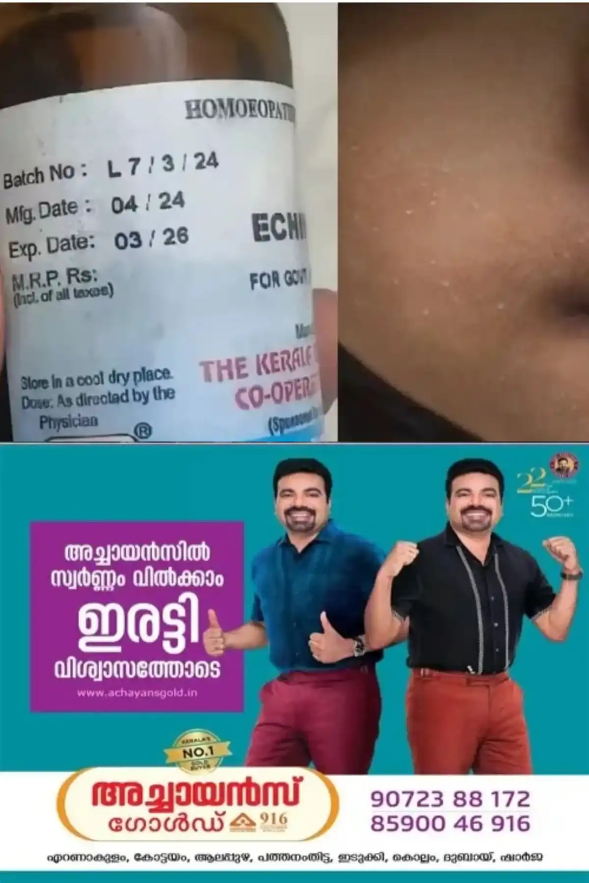 ആറ്റിങ്ങല് സർക്കാർ ഹോമിയോ ആശുപത്രിയില് നാല് വയസുകാരിക്ക് കാലാവധി കഴിഞ്ഞ മരുന്ന് നല്കി; ഡോക്ടര്ക്കും നഴ്സിംഗ് അസിസ്റ്റന്റിനും സസ്പെൻഷൻ