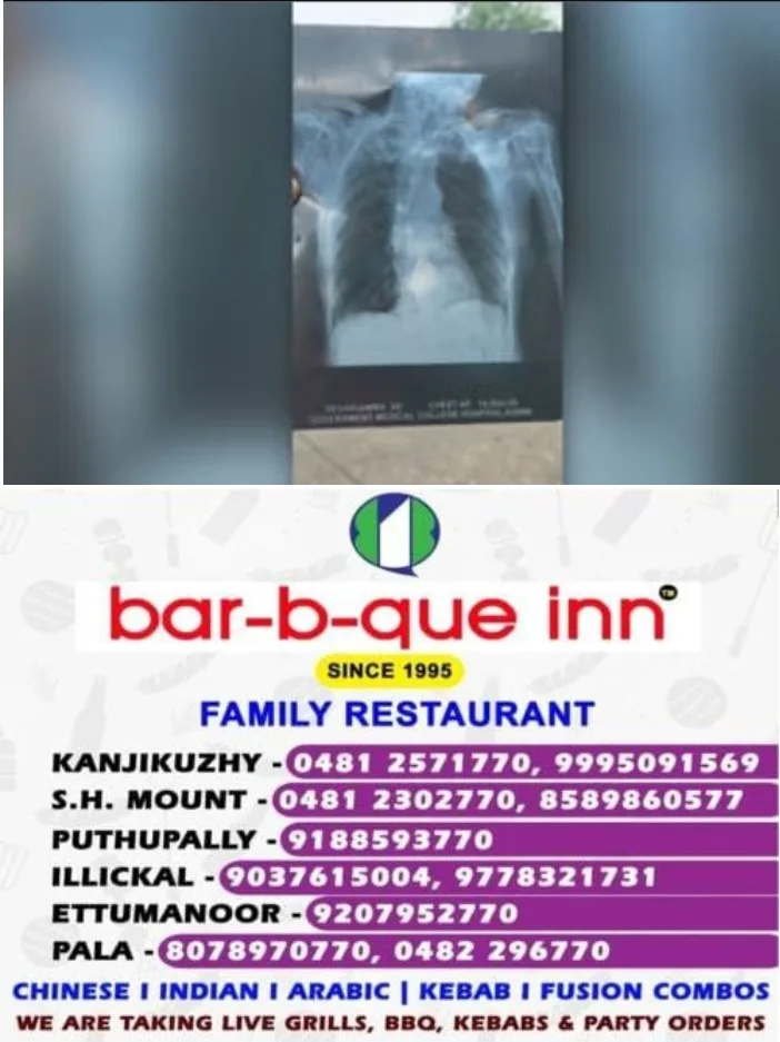 കോന്നി മെഡിക്കൽ കോളേജിൽ 16കാരിക്ക് വയോധികയുടെ എക്സ്റേ ഫിലിം മാറി നൽകി;ചികിത്സാ പിഴവ്: സ്വമേധയാ കേസെടുത്ത് ബാലാവകാശ കമ്മീഷൻ