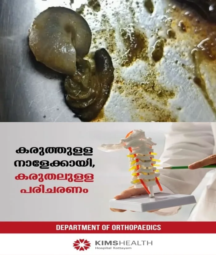 വടക്കൻ പറവൂരിലെ ചായപ്പീടിക' ഹോട്ടലില്‍‌ 'മുട്ടക്കറിയില്‍ ഒച്ച്‌'; ഹോട്ടല്‍ പൂട്ടാൻ ഉത്തരവിട്ട് നഗരസഭ