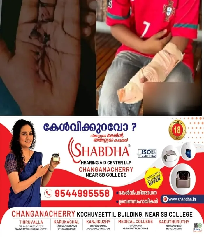 'ഒമ്പതാം ക്ലാസുകാരന്റെ വിരലിന്റെ ചലനശേഷി നഷ്ടമായി'; കോഴിക്കോട് കൊയിലാണ്ടി താലൂക്ക് ആശുപത്രിയില്‍ ചികിത്സാപ്പിഴവെന്ന് പരാതി
