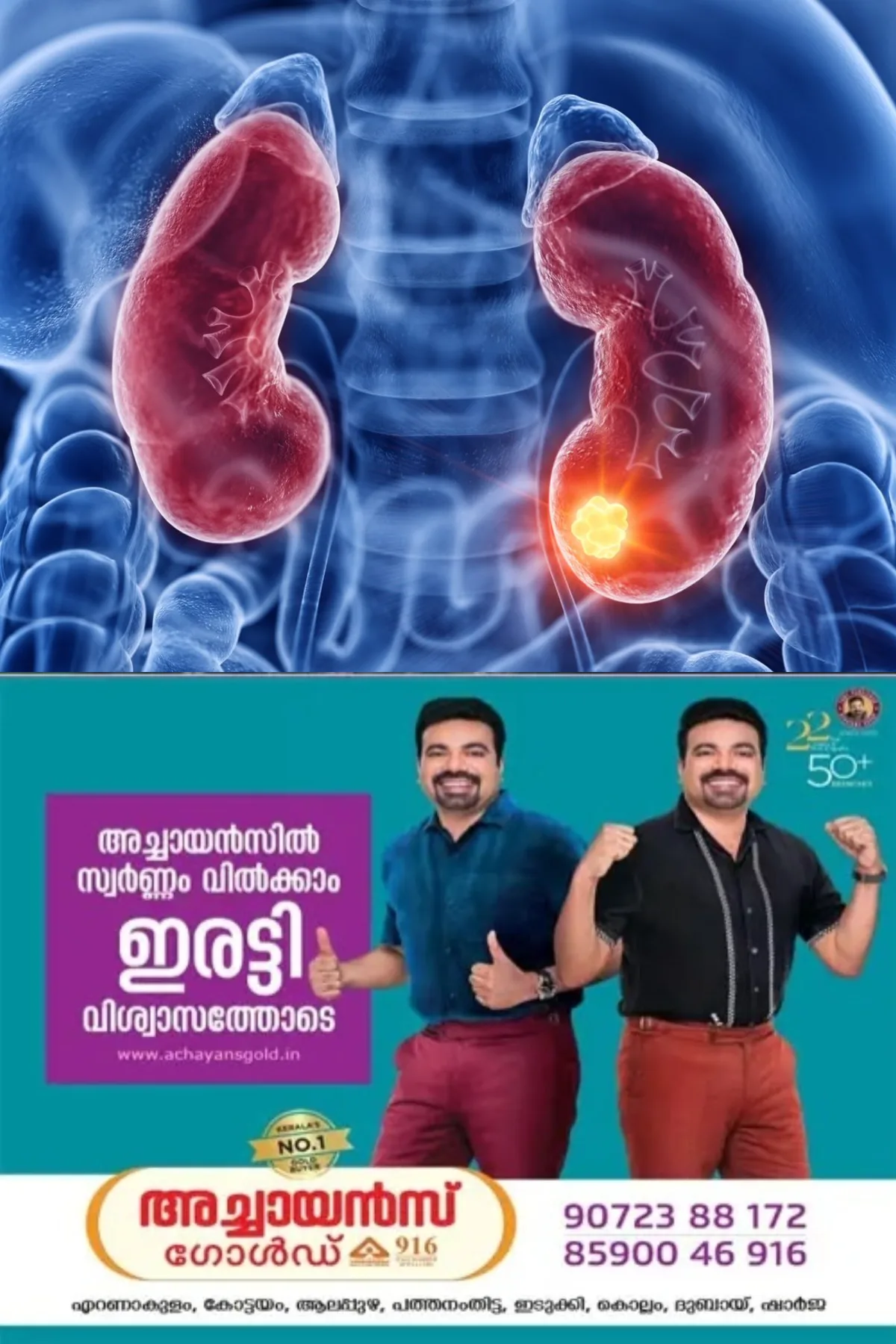 വൃക്ക തകരാർ ; ഒരിക്കലും അവഗണിക്കാൻ പാടില്ലാത്ത 10 ലക്ഷണങ്ങൾ