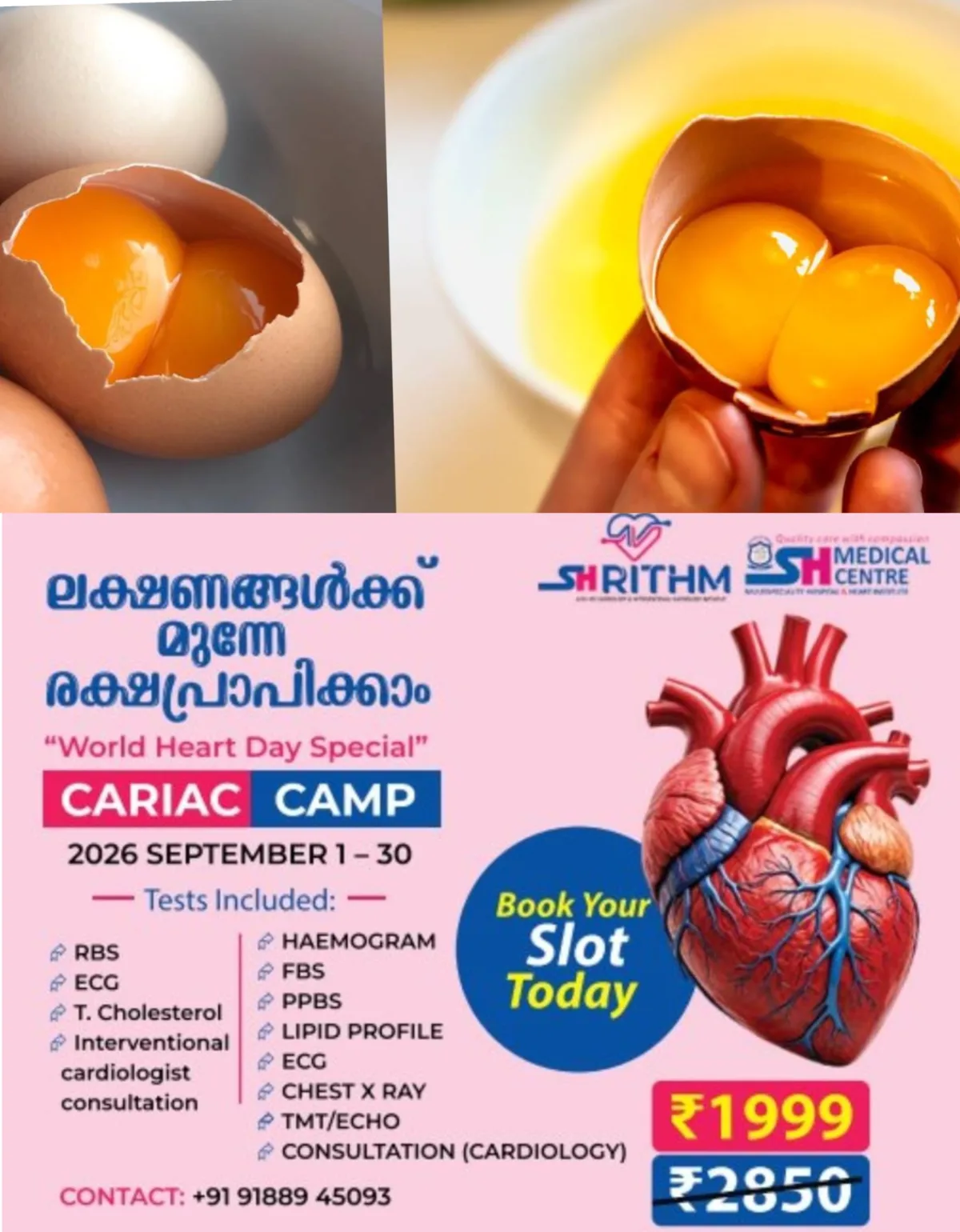 എന്തുകൊണ്ടാണ് ചില മുട്ടയില് രണ്ട് മഞ്ഞക്കരു ഉണ്ടാകുന്നത്?; ഇതിന് പിന്നിലെ ശാസ്ത്രം എന്താണെന്ന് അറിയാം