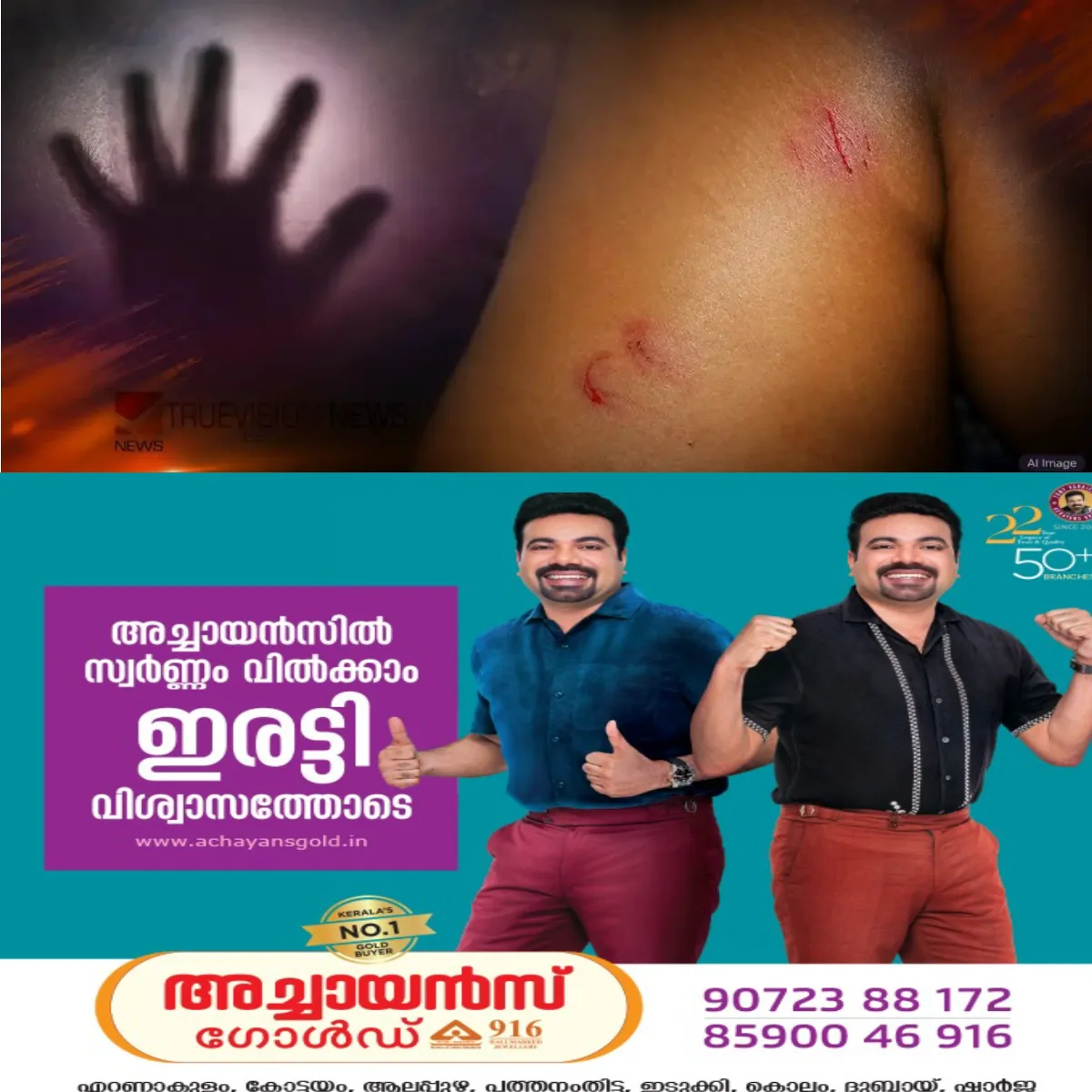 മോഷണം ആരോപിച്ച് പന്ത്രണ്ടുകാരനെ ബന്ധുക്കള് മർദ്ദിച്ച സംഭവത്തില് പരാതി ഒഴിവാക്കാൻ ശ്രമം: പണമോ സൈക്കിളോ നൽകാമെന്ന പ്രതിയുടെ രബ്ദരേഖ പുറത്ത്.
