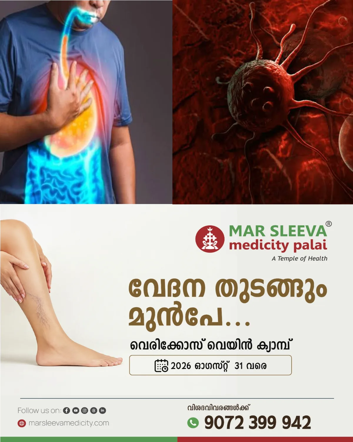 ഗ്യാസും അസിഡിറ്റിയുമെന്ന് കരുതി അവഗണിച്ച ലക്ഷണങ്ങൾ; ഒടുവിൽ കണ്ടെത്തിയത് അപൂർവ കാൻസർ! ഈ ലക്ഷണങ്ങൾ ശ്രദ്ധിക്കണം