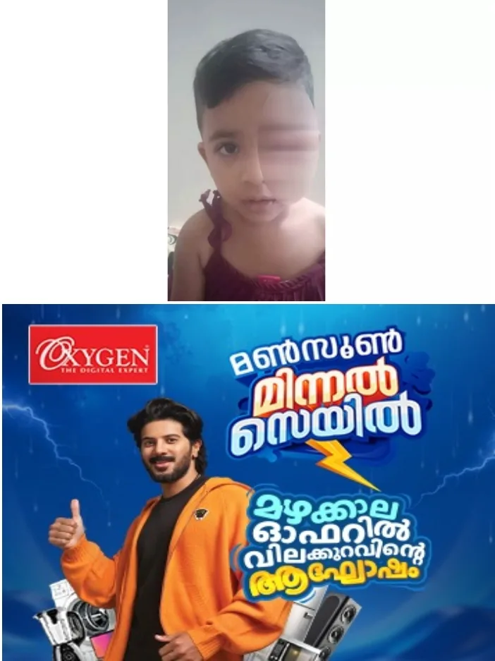 കോഴിക്കോട് വീട്ടു മുറ്റത്ത് കളിക്കുകയായിരുന്ന രണ്ട് വയസുകാരിയുടെ കണ്ണിൽ കടിച്ച് തെരുവ് നായ;രക്ഷിക്കാനെത്തിയ അമ്മക്കും നായയുടെ കടിയേറ്റു