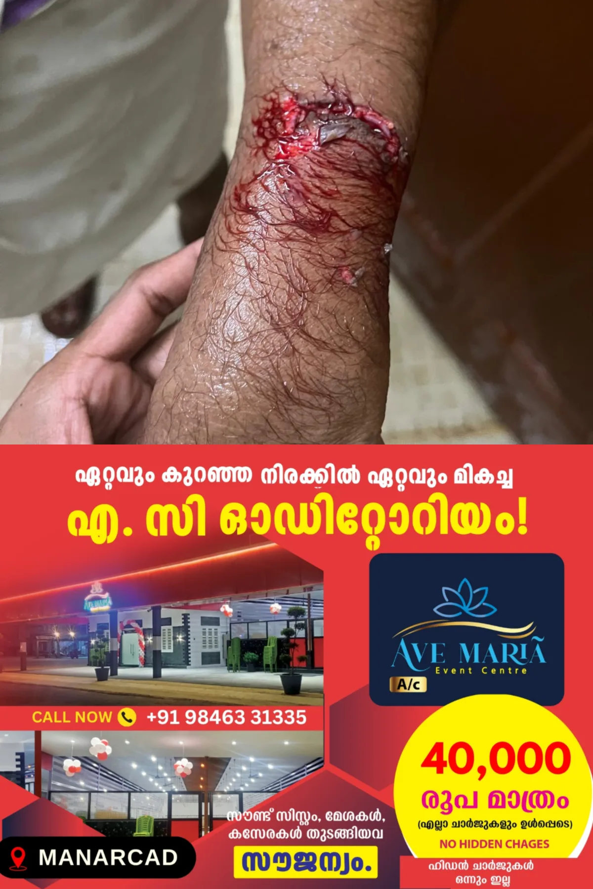 കോട്ടയം വാരിശേരി, ചുങ്കം, കുടയംപടി ഭാഗങ്ങളിൽ തെരുവ് നായ നിരവധി പേരെ കടിച്ചു; പ്രദേശത്തുള്ളവർ ജാഗ്രത പാലിക്കണമെന്ന് മുന്നറിയിപ്പ്