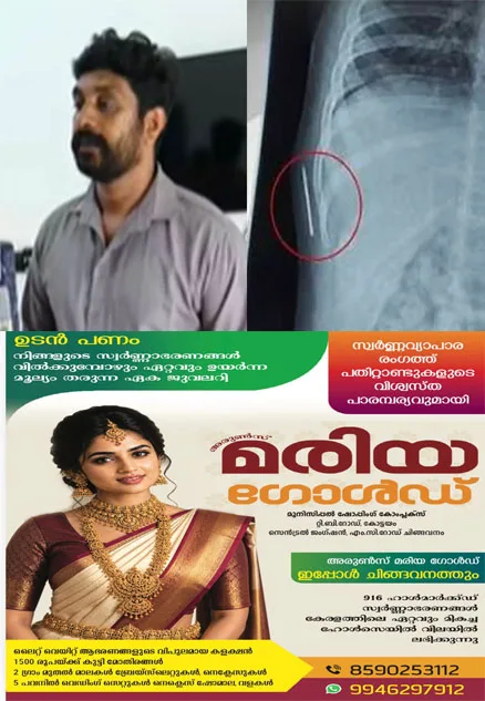 ഒരു വയസുകാരിയുടെ ശരീരത്തില്‍ സൂചി കുടുങ്ങിയ സംഭവം; കോട്ടയം മെഡിക്കൽ കോളജിന്റെ പ്രാഥമിക അന്വേഷണ റിപ്പോർട്ടിനെതിരെ കുടുംബം