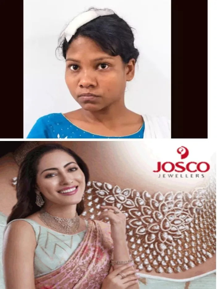 ആറളത്ത് മദ്യപിച്ച് ബഹളമുണ്ടാക്കിയത് ചോദ്യം ചെയ്ത അയല്‍വാസിയെ വെട്ടിപ്പരിക്കേല്‍പ്പിച്ച് യുവതി; മൂക്കിനും ഞരമ്പുകള്‍ക്കും ഗുരുതര പരിക്ക്; 29കാരി റിമാന്‍ഡില്‍