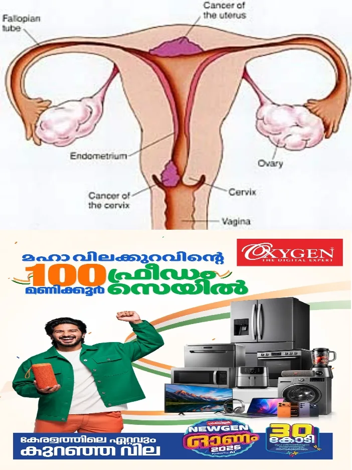 ആര്‍ത്തവമില്ലാത്ത സമയങ്ങളില്‍ രക്തസ്രാവം,ലൈംഗിക ബന്ധത്തിന് ശേഷം  രക്തം; ഈ ലക്ഷണങ്ങളെ നിസ്സാരവൽക്കരിക്കരുത്;.ഗര്‍ഭാശയമുഖ ക്യാന്‍സര്‍; തിരിച്ചറിയാതെ പോകുന്ന ലക്ഷണങ്ങള്‍
