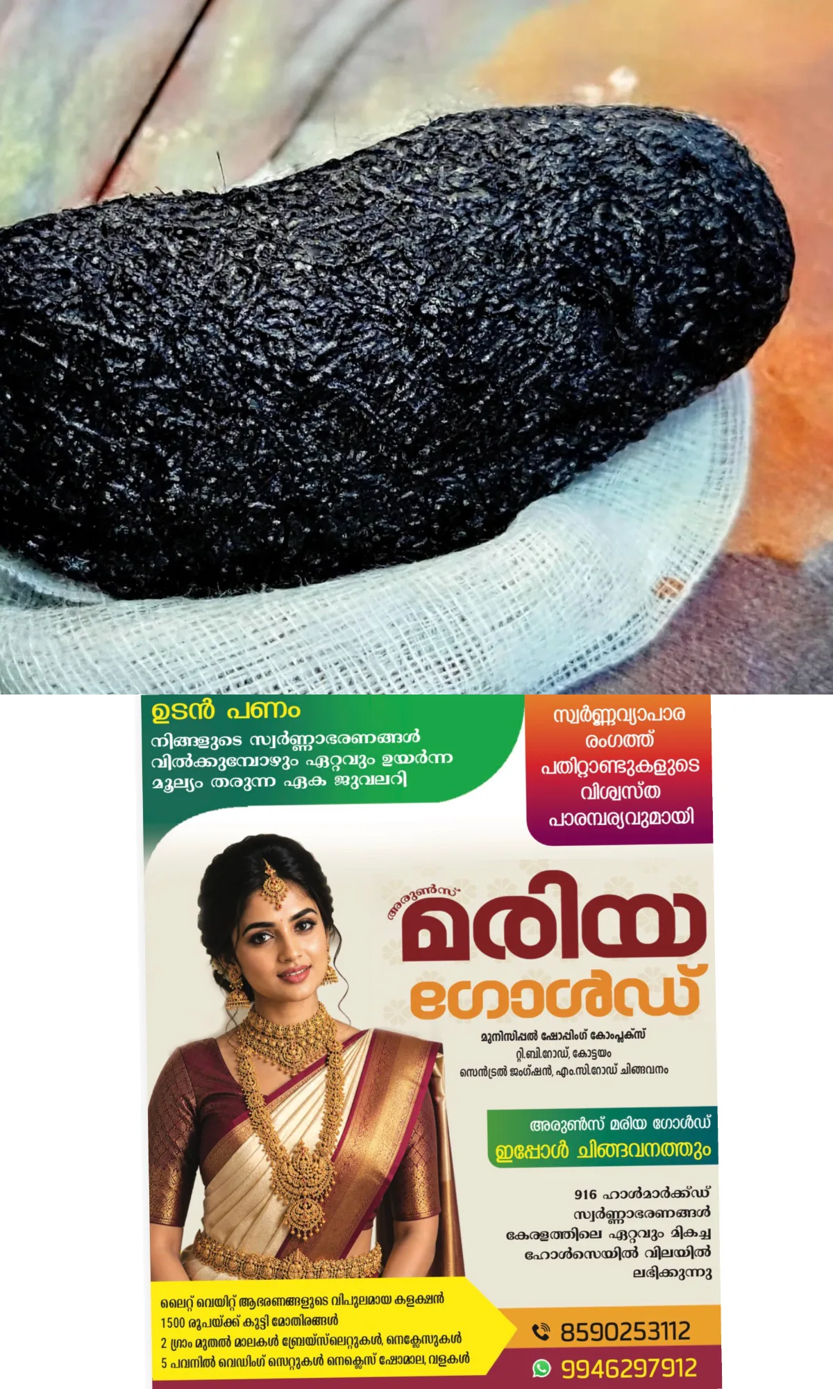 'തുടർച്ചയായി വയറു വേദനയും ഛർദിയും'; പരിശോധനയില് ഒമ്പത് വയസ്സുകാരിയുടെ വയറ്റിൽ നിന്ന് പുറത്തെടുത്തത് ഒരു കിലോ തലമുടി, സംഭവം നെയ്യാറ്റിന്കരയിൽ