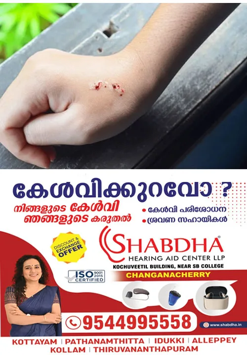 ഹോസ്റ്റലിൽ ഉറങ്ങിക്കിടന്ന വിദ്യാർഥികൾക്ക് പാമ്പ് കടിയേറ്റു; മൂന്നുപേർക്ക് ദാരുണാന്ത്യം;ഒരാളുടെ നില ഗുരുതരം;