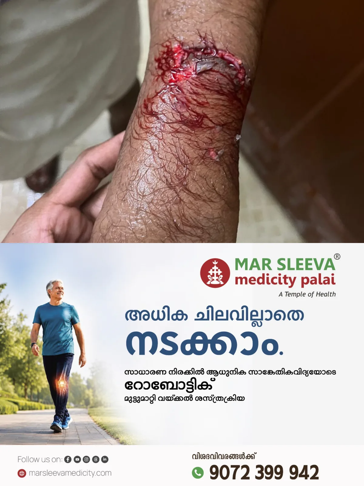 കോട്ടയത്ത് തെരുവുനായ ഭീതി; കുടയംപടി ഭാഗത്ത് തെരുവുനായ ആക്രമണത്തിൽ പത്തു പേർക്ക് കടിയേറ്റു; പരുക്കേറ്റവരെ കോട്ടയം മെഡിക്കൽ കോളേജ് ആശുപത്രിയിൽ പ്രവേശിപ്പിച്ചു