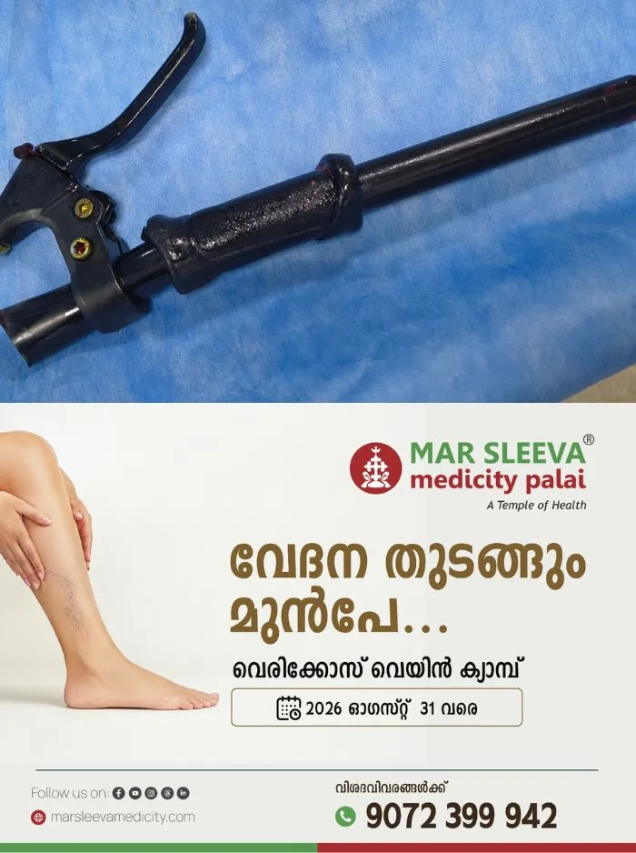 പരീക്ഷയ്ക്കായി സ്കൂളിൽ പോകുന്നതിനിടെ വിദ്യാർത്ഥിയുടെ തുടയിൽ സൈക്കിൾ ഹാൻഡിൽ തുളഞ്ഞു കയറി; മാർ സ്ലീവാ മെഡിസിറ്റിയിൽ നടത്തിയ അടിയന്തിര ശസ്ത്രക്രിയയിലൂടെ ഹാൻഡിൽ നീക്കം ചെയ്തു